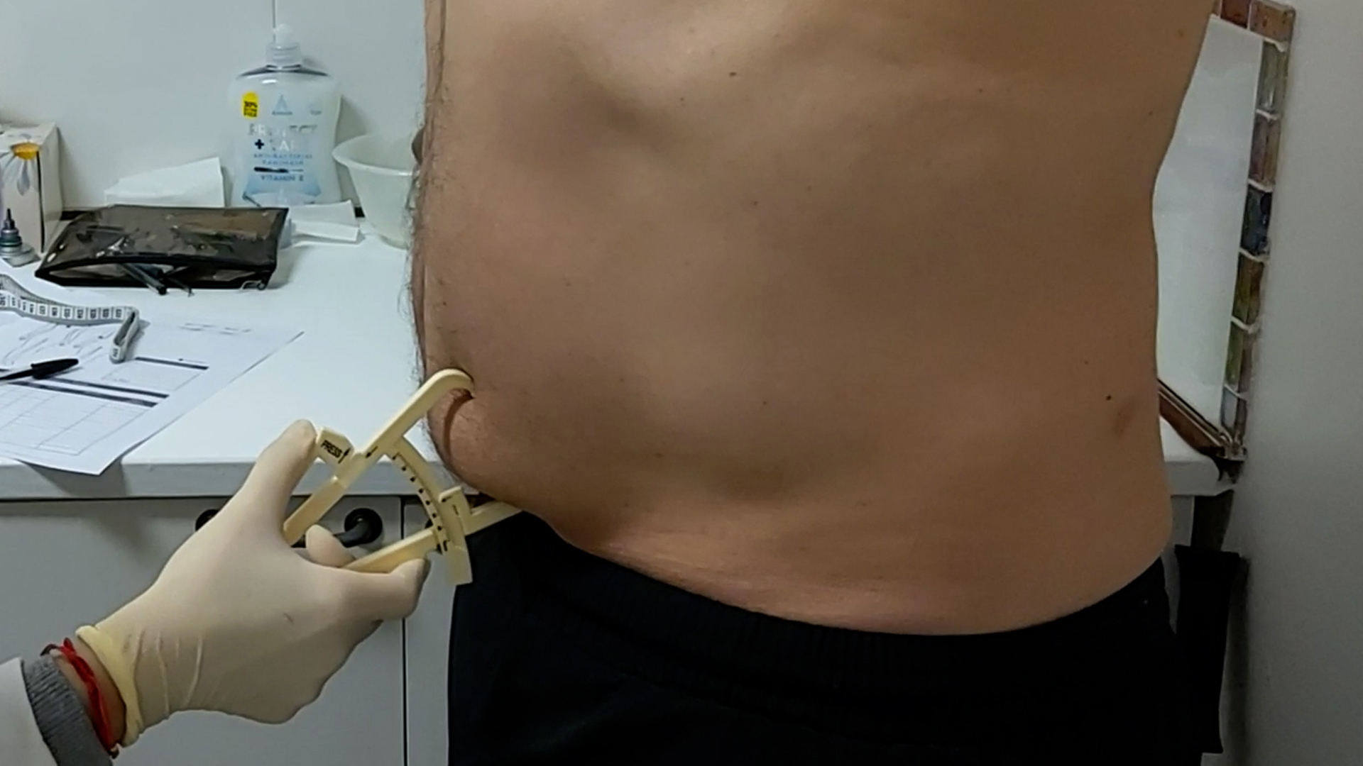 Cryolipolysis fat freezing treatment targeting stubborn fat cells